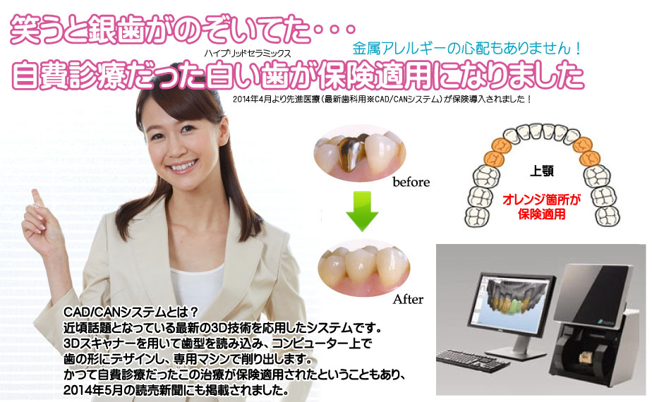2014年4月より先進医療(最新歯科用※CAD/CANシステム)が保険導入されました!