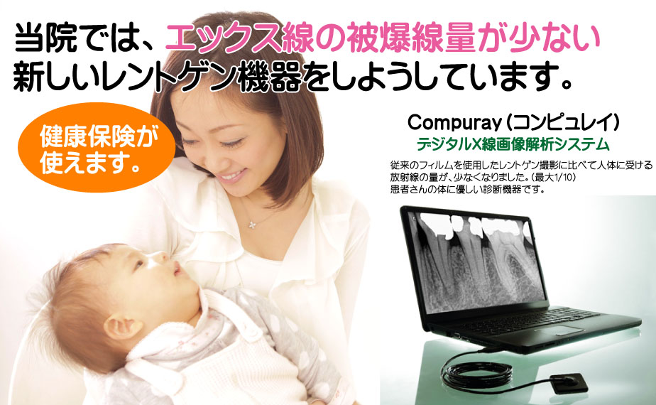 エックス線の被爆線量が少ないレントゲン機器を使用しています (コンピュレイ)